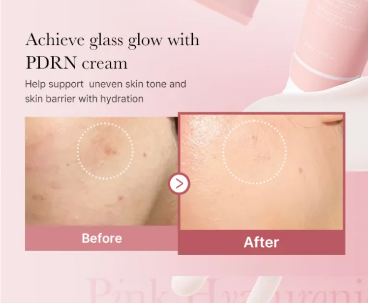 Before and after comparison of skin with Medicure PDRN Hyaluronic Moisturizing cream application on a pink background